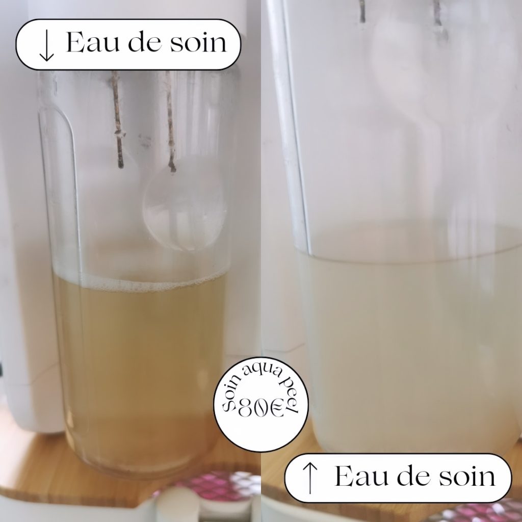 exemple de récupération d'eau après le soin hydrafacial