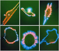 Image kirlian, cellules traitées par sonothérapie avec un xylophone.