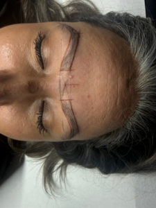 Correction de sourcils